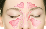 Эндоскопическая операция на пазухах носа