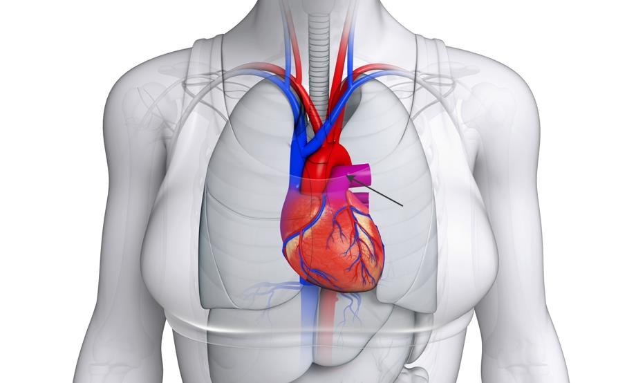 Пороки трехстворчатого клапана10