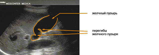 УЗИ печени и желчного пузыря11
