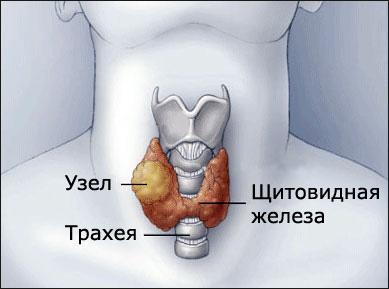 УЗИ щитовидной железы и лимфоузлов шеи10