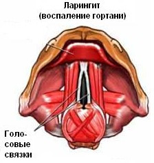Фониатрия10