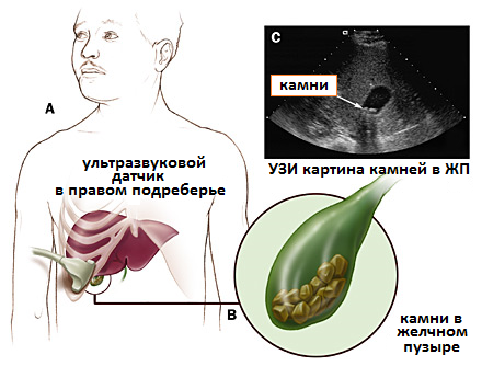 УЗИ печени и желчного пузыря11