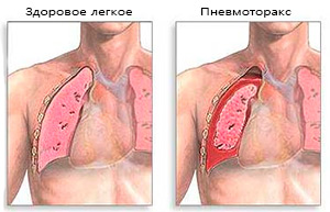 Дыхательная система детей12