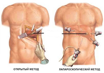 Робот-хирург16