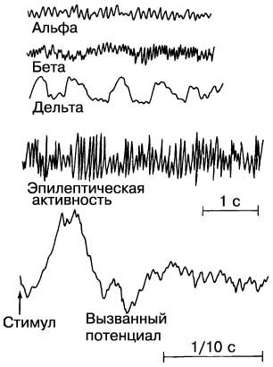 Смерть мозга19