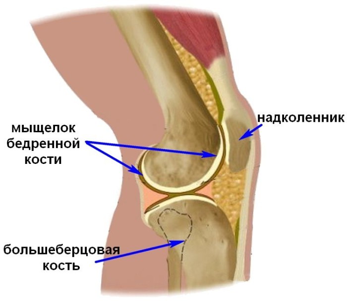 Перелом надколенника1