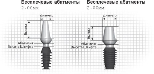 Ретенция абатмента1