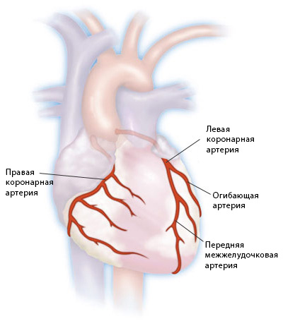 Фистула коронарной артерии1
