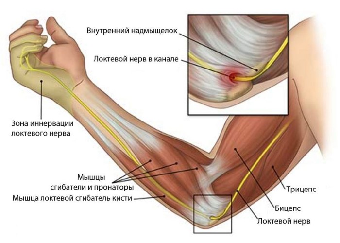 Почему болит рука от кисти до локтя: причины, последствия1