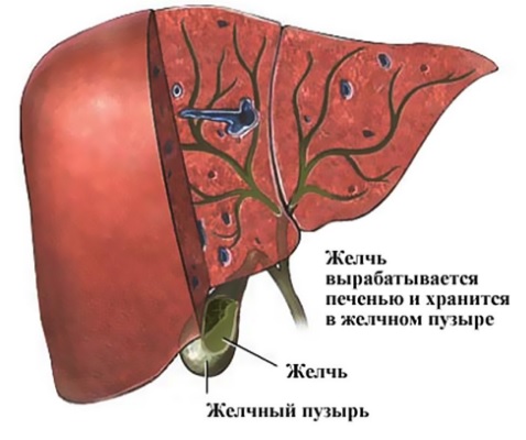 Опухоли желчных протоков2