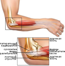Травмы локтевой кости2