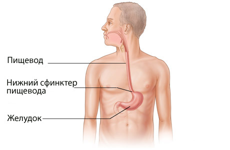 Хирургическое лечение гастроэзофагеальной рефлюксной болезни2