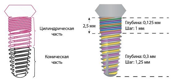 Дизайн имплантата2