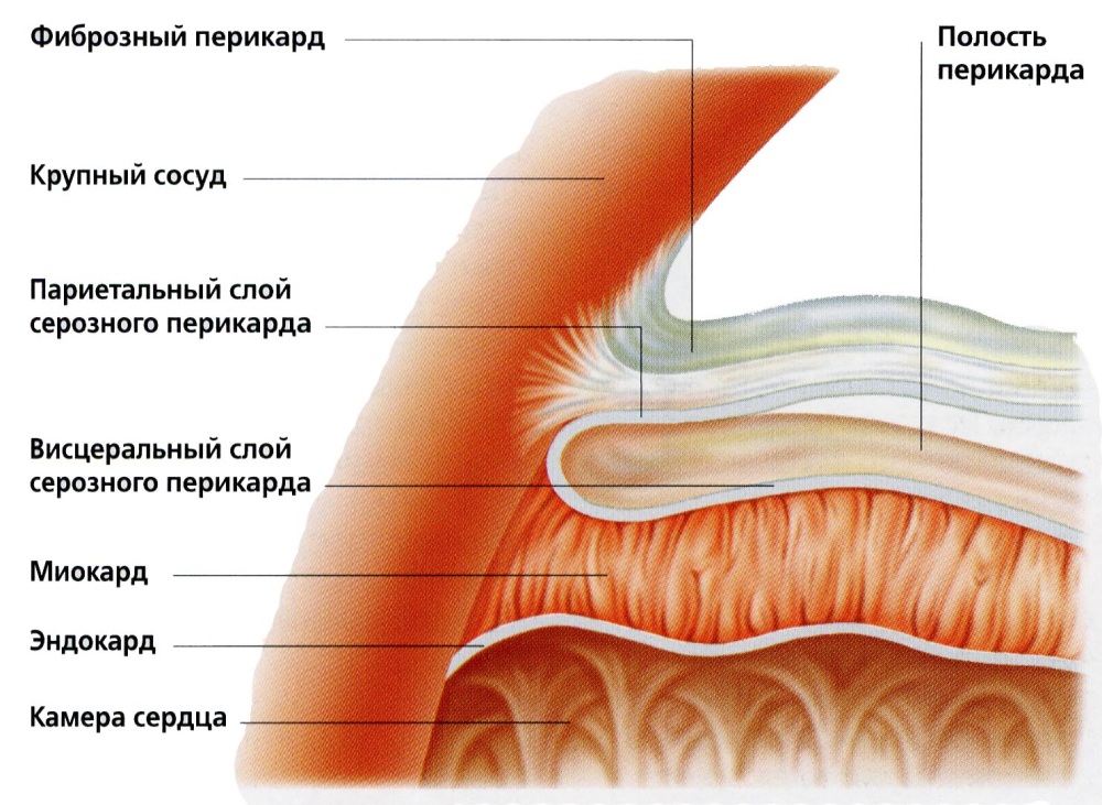 Фистула коронарной артерии2