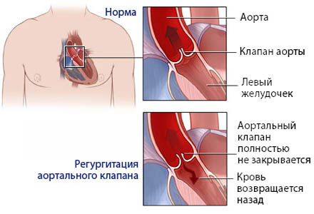 Подготовка к операции на сердце2