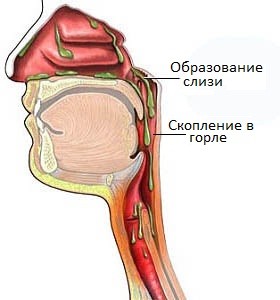 Причины мокроты2