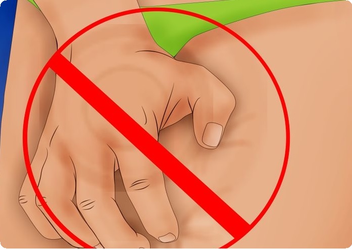 Как избавиться от кондиломы?2