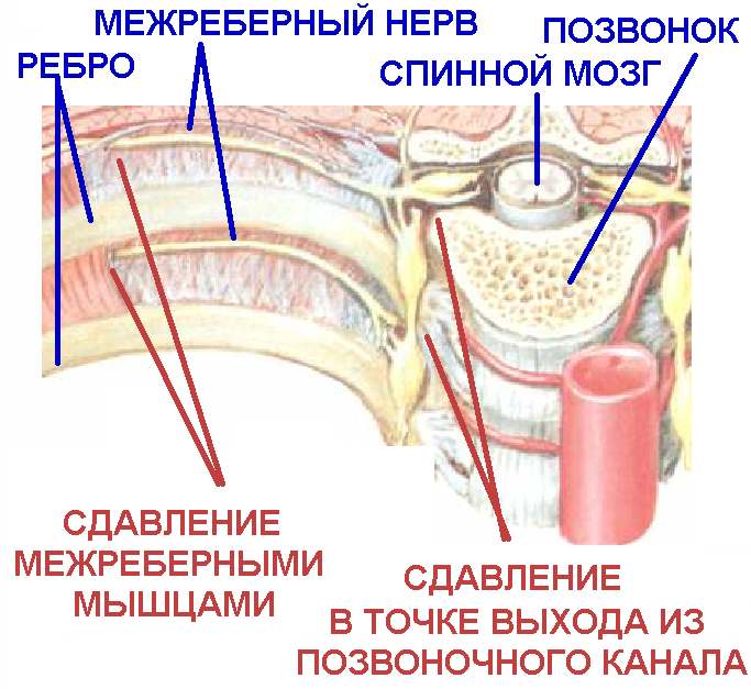 Блокада нерва2