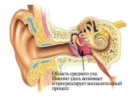 Лабиринтит: симптомы, причины, лечение, последствия2