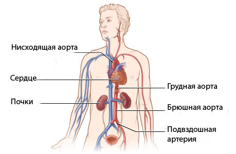 Транспозиция магистральных сосудов: операция, этапы, последствия3