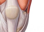 Повреждение связки надколенника