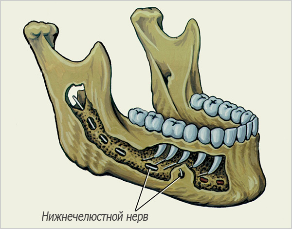 Варианты имплантационного лечения3
