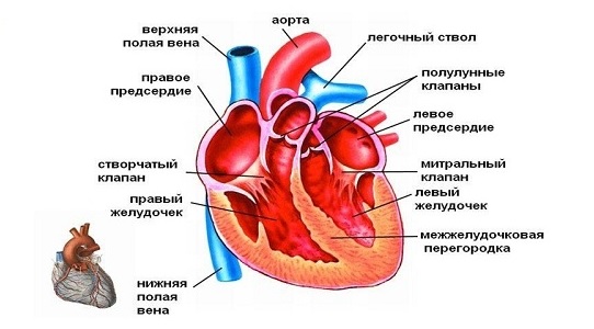 Перерыв дуги аорты у новорожденных3
