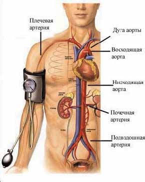 Легочная артериальная гипертензия при ВПС3