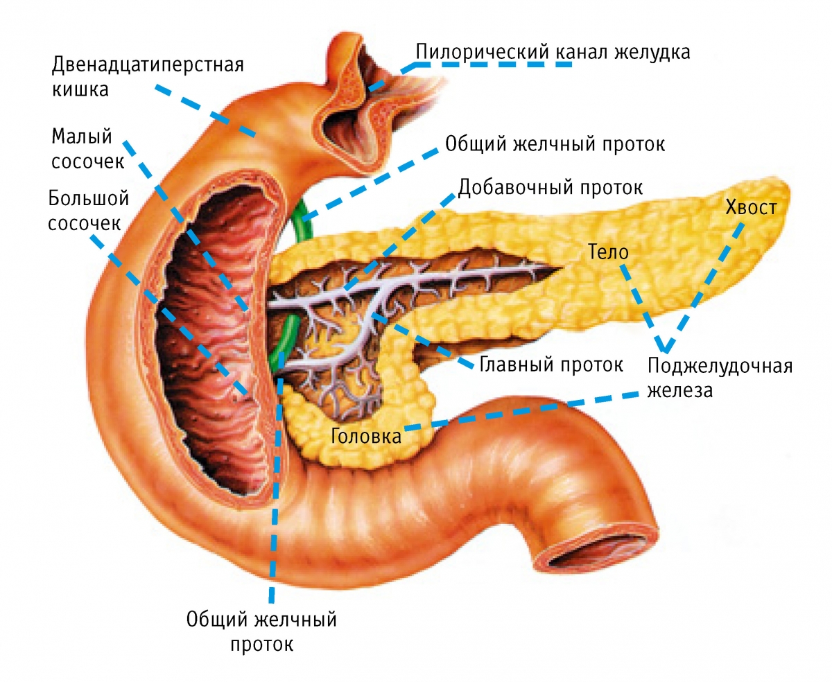 Панкреонекроз3