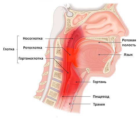 Лечение фарингита: народные средства или медикаментозное лечение3