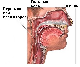 Общие респираторные заболевания3