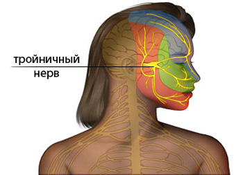Невралгия тройничного нерва. Причины, последствия. 3