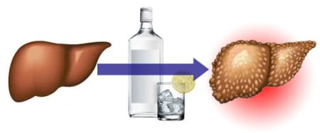 Почему болит печень после еды и алкоголя3