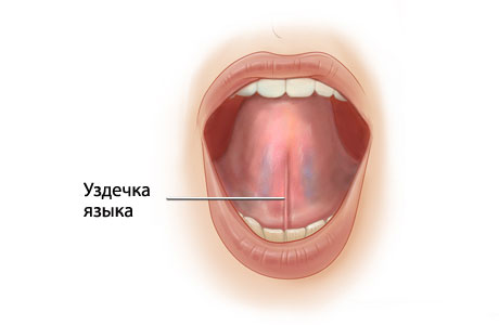 Почему болит уздечка языка3