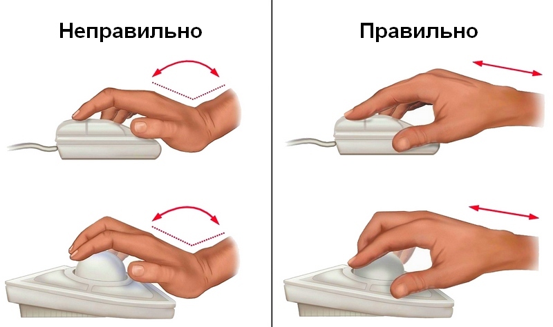 Синдром компьютерной мышки3