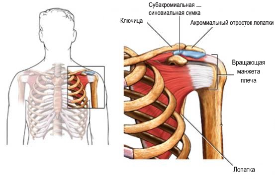 Плечелопаточный периартрит: симптомы, лечение3