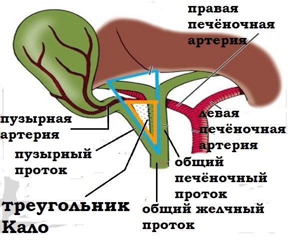 Лапароскопическая холецистэктомия4