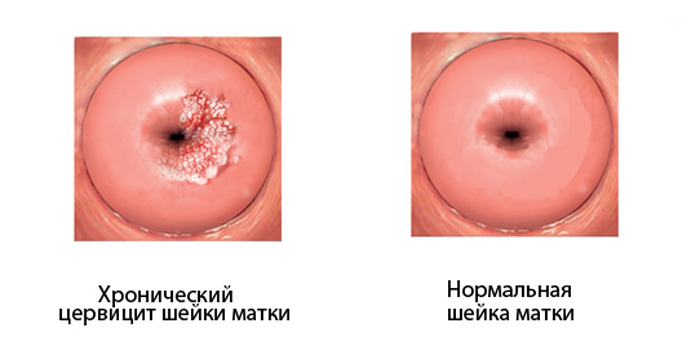 Почему после секса болят яичники4