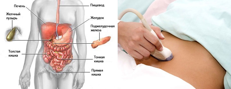 УЗИ брюшной стенки, брюшной полости4