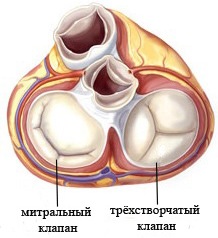 Пороки трехстворчатого клапана4