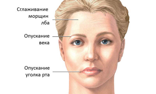 Онемение губ и языка: причины, диагностика5