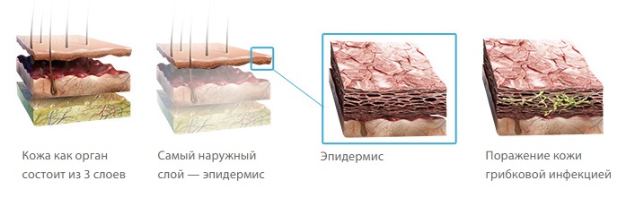Грибок стопы у детей и взрослых4