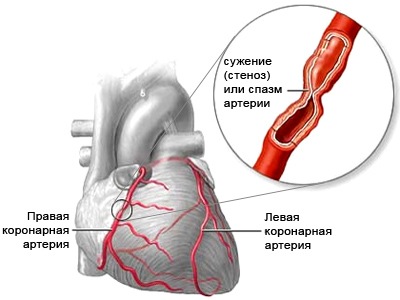 Почему болит между грудью: причины, последствия, методы диагностики4