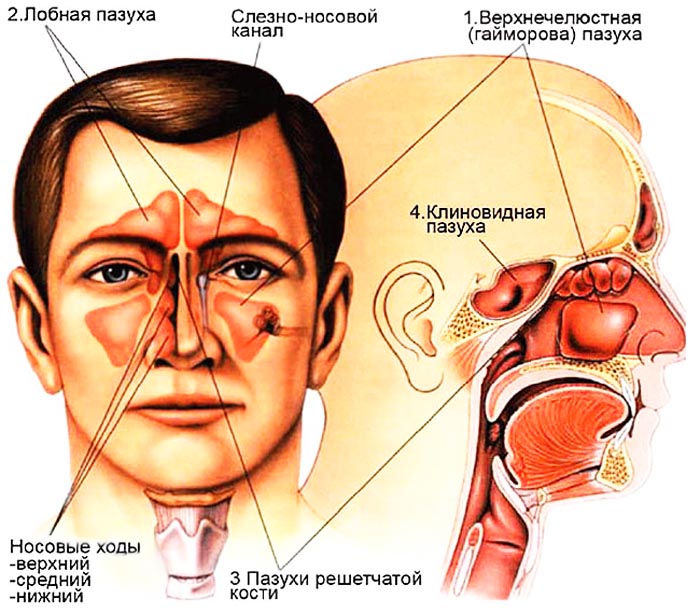 Хирургия носа4