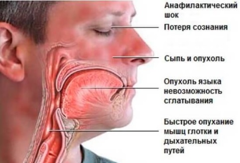 Депрессивно-параноидный синдром5