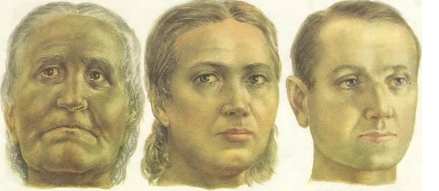 Механическая желтуха: причины, симптомы, лечение5