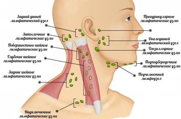 Лимфаденит5