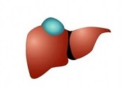 Киста печени: причины, лечение