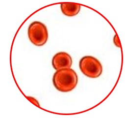 Почему люди болеют цингой5