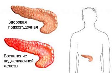 Почему болят бока под рёбрами5